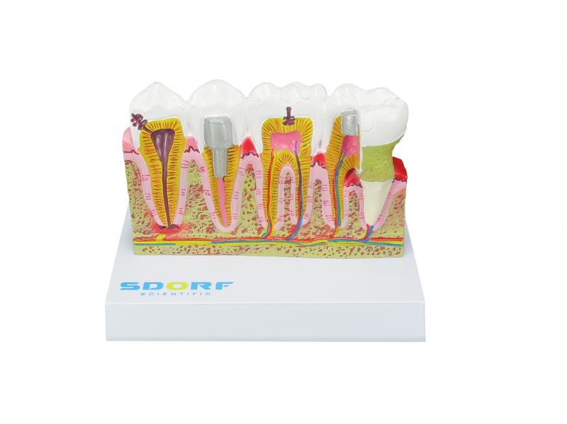 MODELO DE PATOLOGIAS DENTÁRIAS