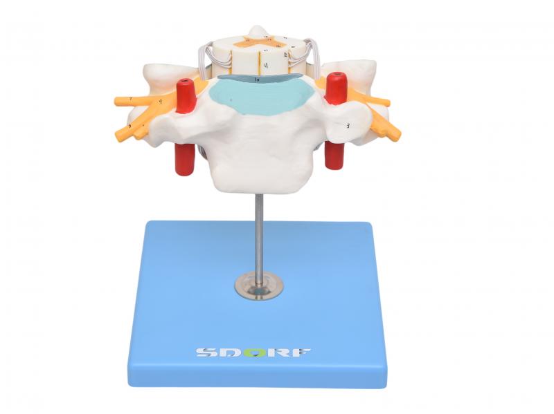 VÉRTEBRA CERVICAL C/ CORDÃO ESPINHAL
