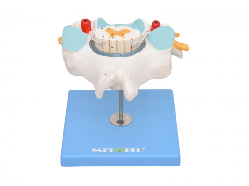 VÉRTEBRA CERVICAL C/ CORDÃO ESPINHAL