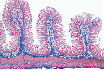 KIT C/ 80 LÂMINAS PREPARADAS ESTUDO HISTOLOGIA